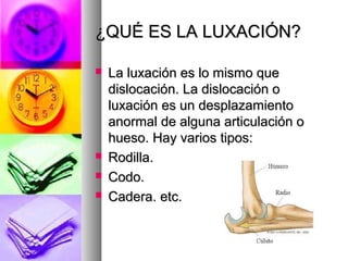 ¿QUÉ ES LA LUXACIÓN?
La luxación es lo mismo que
dislocación. La dislocación o
luxación es un desplazamiento
anormal de alguna articulación o
hueso. Hay varios tipos:
Rodilla.
Codo.
Cadera. etc.