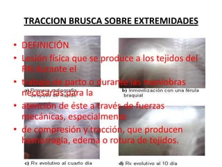 Los episodios y afecciones de la madre pueden contribuir a las contracciones prematuras. Los ejemplos son:DiabetesCardiopatíaInfección (como una infección urinaria o de la membrana amniótica)Nefropatía