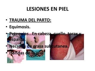 En medicina, el término distocia se emplea cuando el parto o alumbramiento procede de manera anormal o difícil. Puede ser el resultado de contracciones uterinas incoordinadas, de una posición anormal del feto, de una desproporción cefalopélvica relativa o absoluta o por anormalidades que afectan el canal blando del parto.