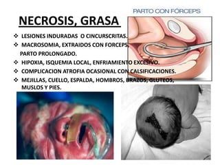 Sin embargo, un embarazo complicado por distocia puede, con frecuencia, llegar a término con el empleo de maniobras obstétricas, como los partos instrumentados -por ejemplo, el uso de fórceps  o, más comúnmente, por una cesárea. Los riesgos reconocidos de una distocia incluyen la muerte fetal, estrés respiratorio, encefalopatía isquémica hipóxica y daño del nervio.