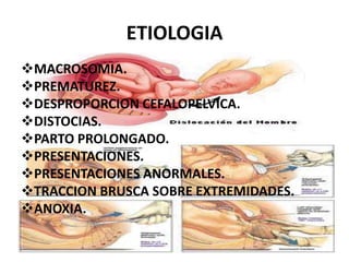 ETIOLOGIAMACROSOMIA.