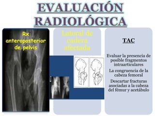 10 
Rx 
anteroposterior 
de pelvis 
Lateral de 
cadera 
afectada 
TAC 
Evaluar la presencia de 
posible fragmentos 
intraarticulares 
La congruencia de la 
cabeza femoral 
Descartar fracturas 
asociadas a la cabeza 
del fémur y acetábulo 
 