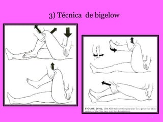3) Técnica de bigelow 
23 
 