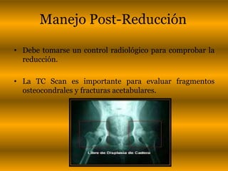Manejo Post-Reducción 
• Debe tomarse un control radiológico para comprobar la 
reducción. 
• La TC Scan es importante para evaluar fragmentos 
osteocondrales y fracturas acetabulares. 
 
