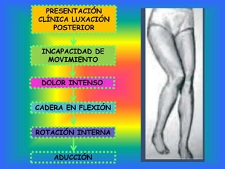 PRESENTACIÓN 
CLÍNICA LUXACIÓN 
POSTERIOR 
INCAPACIDAD DE 
MOVIMIENTO 
DOLOR INTENSO 
CADERA EN FLEXIÓN 
ROTACIÓN INTERNA 
ADUCCIÓN 
 