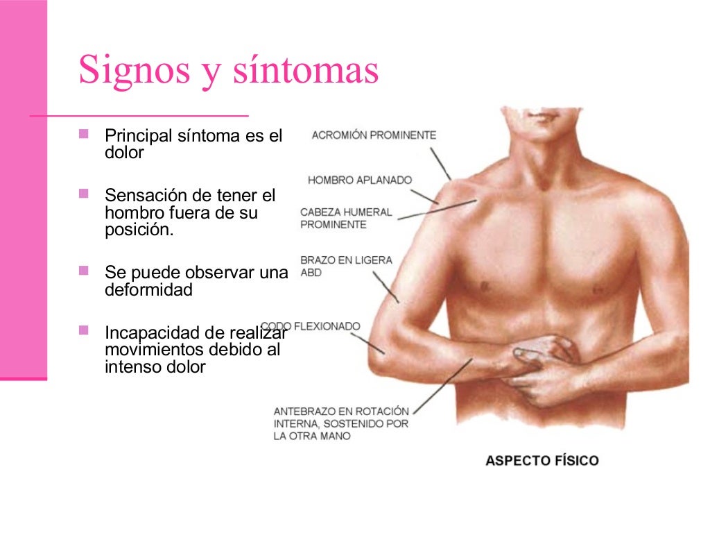 Luxacion anterior de hombro