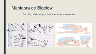 Maniobra de Bigelow
Tracción, abducción, rotación externa y extensión
 