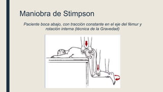 Maniobra de Stimpson
Paciente boca abajo, con tracción constante en el eje del fémur y
rotación interna (técnica de la Gravedad)
 