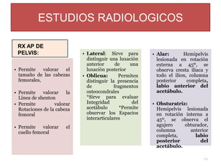 • Permite valorar el
tamaño de las cabezas
femorales,
• Permite valorar la
Línea de shenton
• Permite valorar
Rotaciones de la cabeza
femoral
• Permite valorar el
cuello femoral
• Lateral: Sirve para
distinguir una luxación
anterior de una
luxación posterior
• Oblicua: Permiten
distinguir la presencia
de fragmentos
osteocondrales
*Sirve para evaluar
Integridad del
acetábulo *Permite
observar los Espacios
interarticulares
• Alar: Hemipelvis
lesionada en rotación
externa a 45º, se
observa cresta iliaca y
todo el ilion, columna
posterior completa,
labio anterior del
acetábulo.
• Obsturatriz:
Hemipelvis lesionada
en rotación interna a
45º, se observa el
agujero obturador,
columna anterior
completa, labio
posterior del
acetábulo.
ESTUDIOS RADIOLOGICOS
34
RX AP DE
PELVIS:
 