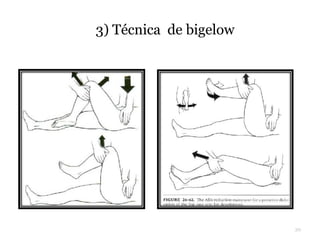3) Técnica de bigelow
39
 