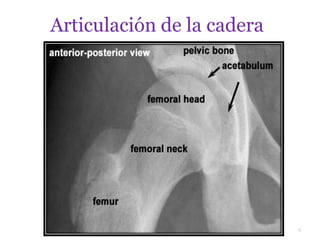 Articulación de la cadera
4
 