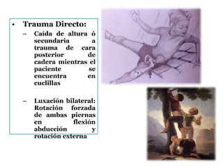 • Trauma Directo:
– Caída de altura ó
secundaria a
trauma de cara
posterior de
cadera mientras el
paciente se
encuentra en
cuclillas
– Luxación bilateral:
Rotación forzada
de ambas piernas
en flexión
abducción y
rotación externa
 