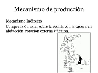 Mecanismo de producción
Mecanismo Indirecto
Comprensión axial sobre la rodilla con la cadera en
abducción, rotación externa y flexión.
 