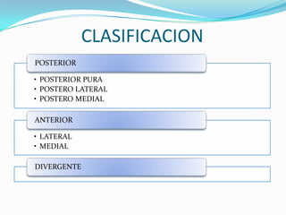 CLASIFICACION
POSTERIOR

• POSTERIOR PURA
• POSTERO LATERAL
• POSTERO MEDIAL

ANTERIOR

• LATERAL
• MEDIAL

DIVERGENTE
 