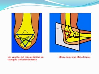 Los 3 puntos del codo delimitan un   Ellos están en un plano frontal
triángulo isósceles de frente
 