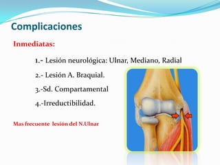 Complicaciones
Inmediatas:

        1.- Lesión neurológica: Ulnar, Mediano, Radial
        2.- Lesión A. Braquial.
        3.-Sd. Compartamental
        4.-Irreductibilidad.

Mas frecuente lesión del N.Ulnar
 
