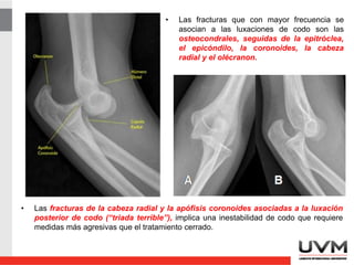 • Las fracturas que con mayor frecuencia se
asocian a las luxaciones de codo son las
osteocondrales, seguidas de la epitróclea,
el epicóndilo, la coronoides, la cabeza
radial y el olécranon.
• Las fracturas de la cabeza radial y la apófisis coronoides asociadas a la luxación
posterior de codo (“triada terrible”), implica una inestabilidad de codo que requiere
medidas más agresivas que el tratamiento cerrado.
 