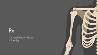 Luxacion de Glenohumeral _traumatología .pptx