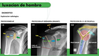 luxacion de hombro.pptx