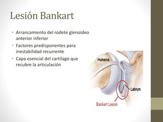 Capa Recurrente luxacion de hombro tipos y partes afectadas | PPTX