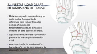 2.- INESTABILIDAD 2ª ART
METATARSIANA DEL TARSO
• Relación segundo metatarsiano y la
cuña media. Será punto de
referencia para reducir todas las
demás articulaciones
tarsometatarsianas, la alineación
correcta en este paso es esencial.
• aguja intramedular distal - proximal y
palanca de mando para alineación
axial.
• Avanza a través de la articulación
hacia la cuña media para asegurar la
alineación correcta
 