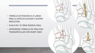 • TORNILLO DE POSICION A O LARGO
PARA LA ARTICUCULACION Y SUJETAR
REDUCCION
• PLACA EN T SI TIENE RESERVA OSEA
• ARTROIDESIS TORNILLO DE TRACCION
TRANSARTICULAR CON INJERT OSEO
 