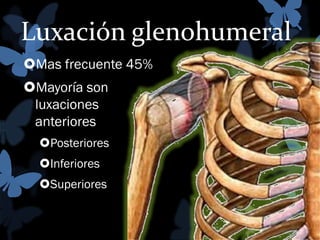 Luxación glenohumeral
Mas frecuente 45%
Mayoría son
luxaciones
anteriores
Posteriores
Inferiores
Superiores

 