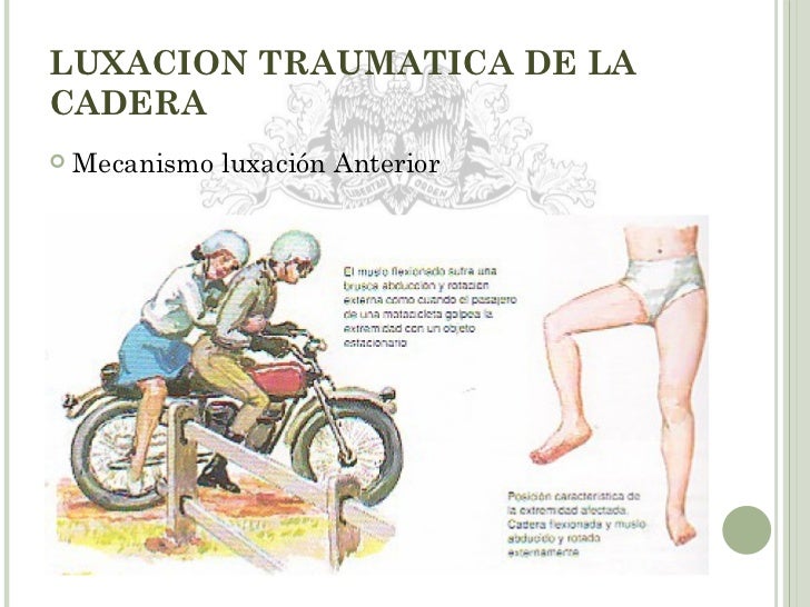 La quiropráctica el tratamiento de la hernia de la columna vertebral las revocaciones