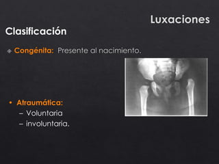Clasificación
• Atraumática:
– Voluntaria
– involuntaria.
 
