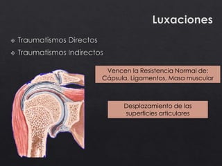Vencen la Resistencia Normal de:
Cápsula, Ligamentos, Masa muscular
Desplazamiento de las
superficies articulares
 