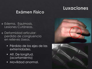 Luxaciones
• Pérdida de los ejes de las
extremidades.
• Alt. De longitud.
(acortamiento)
• Movilidad anormal.
 