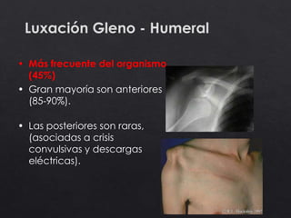Luxación Gleno - Humeral
• Más frecuente del organismo
(45%)
• Gran mayoría son anteriores
(85-90%).
• Las posteriores son raras,
(asociadas a crisis
convulsivas y descargas
eléctricas).
 