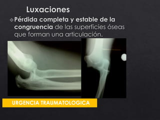 URGENCIA TRAUMATOLOGICA
 