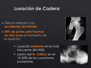 42
Luxación de Cadera
• Luxación posterior en la más
frecuente (85-90%)
• Lesión del N. Ciático en el
10-20% de las Luxaciones
posteriores.
 