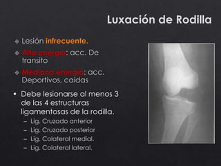 Luxación de Rodilla
• Debe lesionarse al menos 3
de las 4 estructuras
ligamentosas de la rodilla.
– Lig. Cruzado anterior
– Lig. Cruzado posterior
– Lig. Colateral medial.
– Lig. Colateral lateral.
 