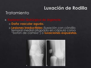 Luxación de Rodilla
Tratamiento
 