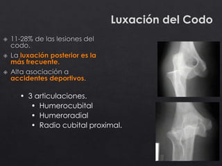 Luxación del Codo
• 3 articulaciones.
• Humerocubital
• Humeroradial
• Radio cubital proximal.
 
