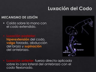Luxación del Codo
• Caída sobre la mano con
el codo extendido.
• Luxación posterior:
hiperextensión del codo,
valgo forzado, abducción
del brazo y supinación
del antebrazo.
• Luxación anterior: fuerza directa aplicada
sobre la cara lateral del antebrazo con el
codo flexionado.
 