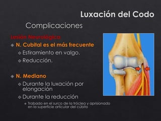 Luxación del Codo
 