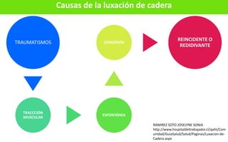 Causas de la luxación de cadera
TRAUMATISMOS
TRACCCIÓN
MUSCULAR
ESPONTÁNEA
CONGÉNITA
REINCIDENTE O
REDIDIVANTE
RAMIREZ SOTO JOSELYNE SONIA
http://www.hospitaldeltrabajador.cl/qaht/Com
unidad/GuiaSalud/Salud/Paginas/Luxacion-de-
Cadera.aspx
 