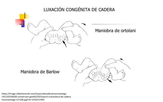 https://image.slidesharecdn.com/luxacindecaderatraumatologa-
141120193020-conversion-gate02/95/luxacin-traumatica-de-cadera-
traumatologa-13-638.jpg?cb=1416511942
 