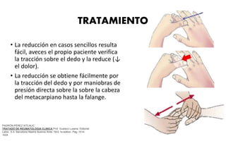 TRATAMIENTO
• La reducción en casos sencillos resulta
fácil, aveces el propio paciente verifica
la tracción sobre el dedo y la reduce (↓
el dolor).
• La reducción se obtiene fácilmente por
la tracción del dedo y por maniobras de
presión directa sobre la sobre la cabeza
del metacarpiano hasta la falange.
PADRÓN PÉREZ XITLALIC
TRATADO DE REUMATOLOGIA CLINICA Prof. Gustavo Lusena Editorial:
Labor, S.A. Barcelona Madrid Buenos Aires 1933 1a edition. Pag. 1014-
1024
 