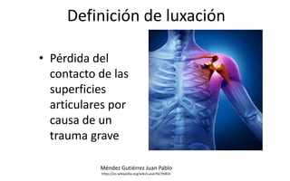 Definición de luxación
• Pérdida del
contacto de las
superficies
articulares por
causa de un
trauma grave
Méndez Gutiérrez...