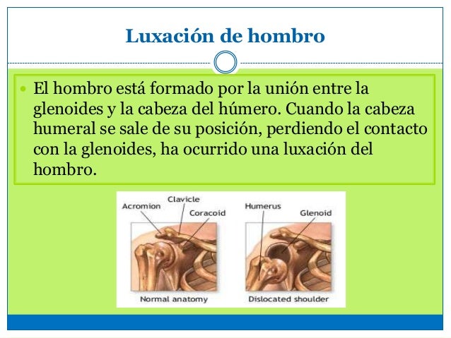 La crema para el aumento del miembro viril de los tacos