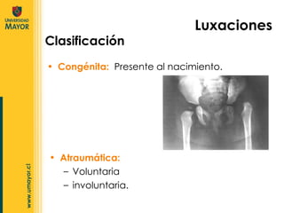 Congénita:  Presente al nacimiento.  Luxaciones Clasificación Atraumática:  Voluntaria involuntaria.  