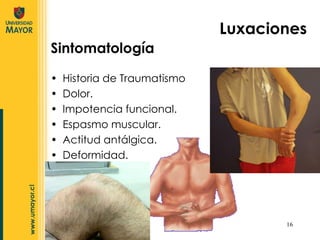 Sintomatología Historia de Traumatismo Dolor. Impotencia funcional. Espasmo muscular. Actitud antálgica. Deformidad. Luxaciones 