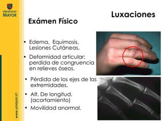 Exámen Físico Edema,  Equimosis, Lesiones Cutáneas. Deformidad articular: perdida de congruencia en relieves óseos. Luxaciones Pérdida de los ejes de las extremidades. Alt. De longitud. (acortamiento) Movilidad anormal. 