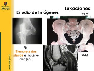 Estudio de Imágenes  Rx. Siempre a dos planos  e inclusive axial(es). TAC RNM Luxaciones 