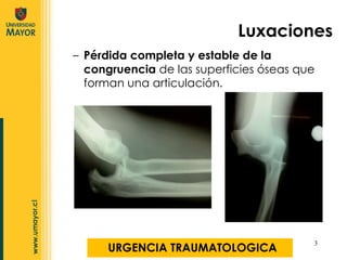 Luxaciones Pérdida completa y estable de la congruencia  de las superficies óseas que forman una articulación. URGENCIA TRAUMATOLOGICA 