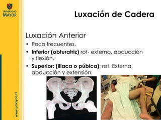 Poco frecuentes. Inferior (obturatriz)  rot- externa, abducción y flexión. Superior: (iliaca o púbica) : rot. Externa, abducción y extensión. Luxación de Cadera Luxación Anterior 